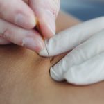 Agopuntura, Mesoterapia e Dry Needling